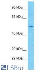 RBMY1A1 antibody Western Blot of MCF7. Antibody dilution: 1 ug/ml.