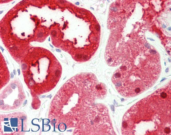 Anti-PSAT1 antibody IHC staining of human kidney. Immunohistochemistry of formalin-fixed, paraffin-embedded tissue after heat-induced antigen retrieval. Antibody LS-B10505 concentration 5 ug/ml.