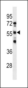 RBMY1D Antibody western blot of NCI-H460 cell line lysates (35 ug/lane). The RBMY1D antibody detected the RBMY1D protein (arrow).