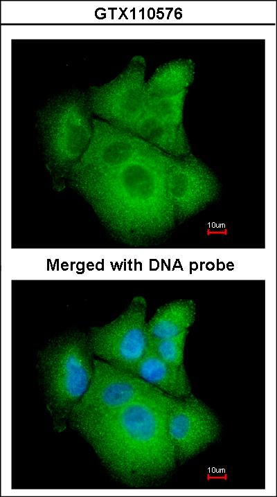 Immunofluorescence of paraformaldehyde-fixed A549 using PSAT1 antibody at 1:200 dilution.