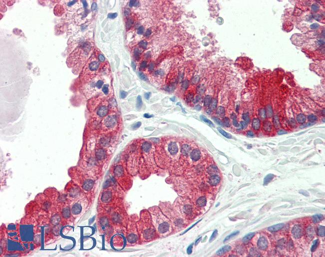 Anti-PSCA antibody IHC of human prostate. Immunohistochemistry of formalin-fixed, paraffin-embedded tissue after heat-induced antigen retrieval. Antibody LS-B3332 concentration 10 ug/ml.