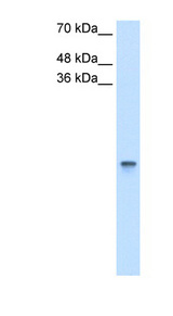 RBP1 antibody LS-C40361 Western blot of HCT116 cell lysate.