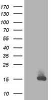HEK293T cells were transfected with the pCMV6-ENTRY control (Left lane) or pCMV6-ENTRY RBP1 (Right lane) cDNA for 48 hrs and lysed. Equivalent amounts of cell lysates (5 ug per lane) were separated by SDS-PAGE and immunoblotted with anti-RBP1.