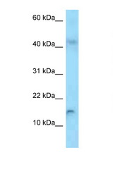 RBP2 antibody LS-C146496 Western blot of HepG2 Cell lysate. Antibody concentration 1 ug/ml.