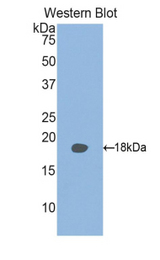 Western blot of recombinant RBP2 / CRBPII.