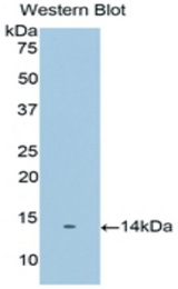 Western blot of recombinant PSCA.