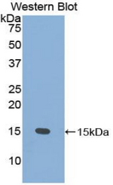 Western blot of recombinant PSCA.