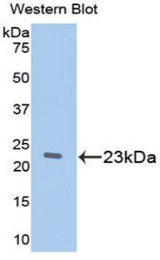 Western blot of recombinant RBP5.