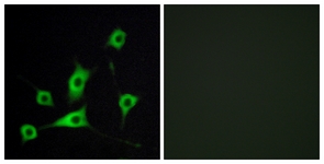 Immunofluorescence of LOVO cells, using RBP5 Antibody. The picture on the right is treated with the synthesized peptide.