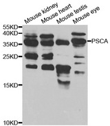 Western blot analysis of extracts of various cell lines, using PSCA antibody.