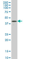 RBPJ monoclonal antibody (M01), clone 4E12 Western Blot analysis of RBPJ expression in Jurkat.