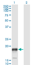Western blot of PSCA expression in transfected 293T cell line by PSCA monoclonal antibody (M02), clone 1E1.