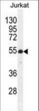 RBPJL Antibody western blot of Jurkat cell line lysates (35 ug/lane). The RBPJL antibody detected the RBPJL protein (arrow).