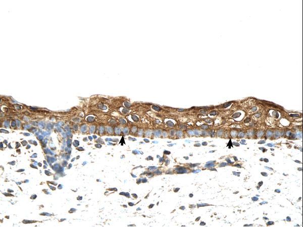 RBPMS antibody LS-C80311 was used in IHC to stain formalin-fixed, paraffin-embedded human skin.