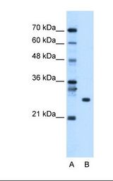 Lane A: Marker. Lane B: HepG2 cell lysate. Antibody concentration: 1.25 ug/ml. Gel concentration: 12%.