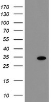 HEK293T cells were transfected with the pCMV6-ENTRY control (Left lane) or pCMV6-ENTRY RBPMS (Right lane) cDNA for 48 hrs and lysed. Equivalent amounts of cell lysates (5 ug per lane) were separated by SDS-PAGE and immunoblotted with anti-RBPMS.