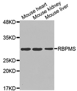 Western blot analysis of extracts of various cell lines, using RBPMS antibody.