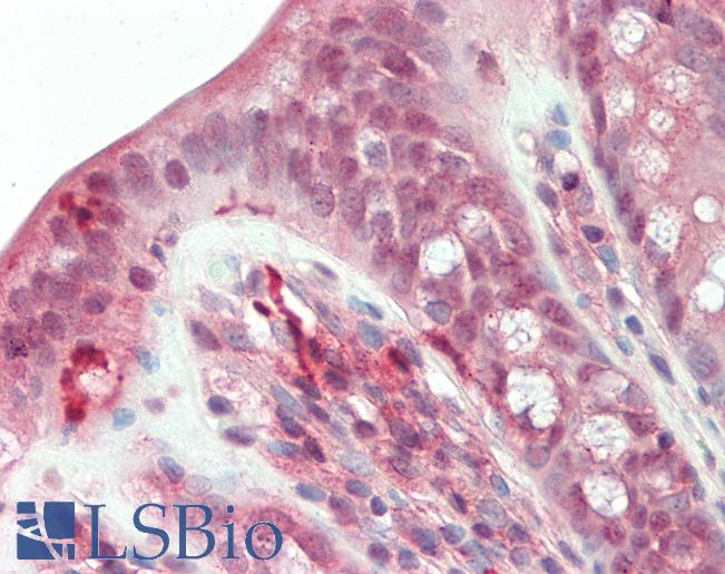 Anti-RBPMS / Hermes antibody IHC staining of human colon. Immunohistochemistry of formalin-fixed, paraffin-embedded tissue after heat-induced antigen retrieval. Antibody LS-B10310 concentration 5 ug/ml.