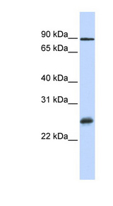 RBPMS antibody Western blot of MCF7 cell lysate.