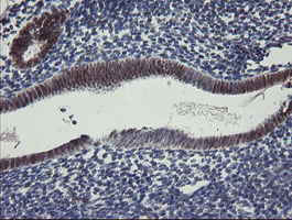 IHC of paraffin-embedded Human endometrium tissue using anti-RBPMS mouse monoclonal antibody.