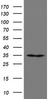 HEK293T cells were transfected with the pCMV6-ENTRY control (Left lane) or pCMV6-ENTRY RBPMS (Right lane) cDNA for 48 hrs and lysed. Equivalent amounts of cell lysates (5 ug per lane) were separated by SDS-PAGE and immunoblotted with anti-RBPMS.