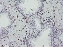 IHC of paraffin-embedded Human prostate tissue using anti-RBPMS mouse monoclonal antibody.