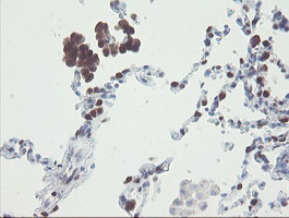 IHC of paraffin-embedded Human lung tissue using anti-RBPMS mouse monoclonal antibody.