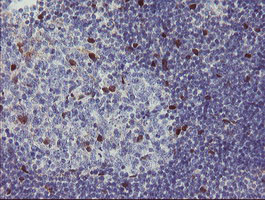 IHC of paraffin-embedded Human tonsil using anti-RBPMS mouse monoclonal antibody.