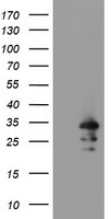 HEK293T cells were transfected with the pCMV6-ENTRY control (Left lane) or pCMV6-ENTRY RBPMS (Right lane) cDNA for 48 hrs and lysed. Equivalent amounts of cell lysates (5 ug per lane) were separated by SDS-PAGE and immunoblotted with anti-RBPMS.