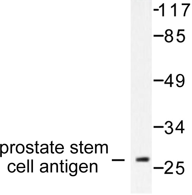 Western blot of Prostate Stem Cell Antigen (V71) pAb in extracts from HepG2 cells.