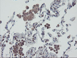 IHC of paraffin-embedded Human lung tissue using anti-RBPMS mouse monoclonal antibody.