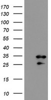 HEK293T cells were transfected with the pCMV6-ENTRY control (Left lane) or pCMV6-ENTRY RBPMS (Right lane) cDNA for 48 hrs and lysed. Equivalent amounts of cell lysates (5 ug per lane) were separated by SDS-PAGE and immunoblotted with anti-RBPMS.