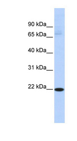 RBPMS2 antibody LS-C110615 Western blot of Fetal Liver lysate.