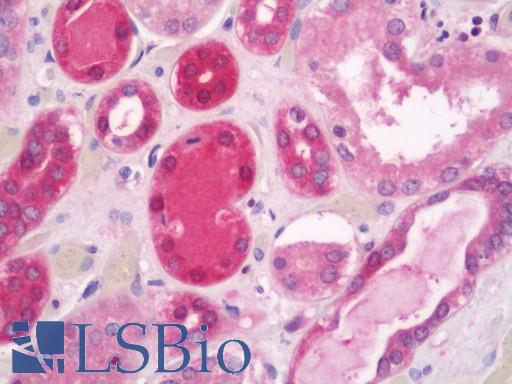 Anti-PSCA antibody IHC staining of human kidney. Immunohistochemistry of formalin-fixed, paraffin-embedded tissue after heat-induced antigen retrieval. Antibody LS-B11345 concentration 20 ug/ml.