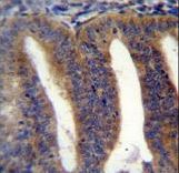 RBPMS2 Antibody immunohistochemistry of formalin-fixed and paraffin-embedded human uterus tissue followed by peroxidase-conjugated secondary antibody and DAB staining.