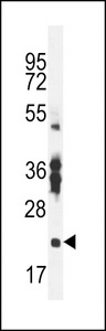 RBPMS2 Antibody western blot of mouse stomach tissue lysates (35 ug/lane). The RBPMS2 antibody detected the RBPMS2 protein (arrow).