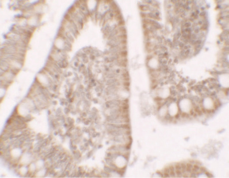 Immunohistochemistry of RC3H1 in human small intestine tissue with RC3H1 antibody at 5 ug/ml.