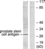 Western blot of extracts from HepG2 cells, using Prostate Stem Cell Antigen Antibody. The lane on the right is treated with the synthesized peptide.