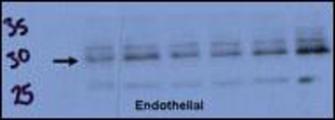 Endothelial cell lysate transferred to membrane was incubated with primary antibody at a 1:500 dilution in 2% BSA in TBST at 4 deg C overnight. Data courtesy of Dr. Katherine Healey, NWCRF Institute, School of Biological Sciences, University of Wales Bangor.