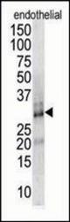 The anti-DSCR1 antibody is used in Western blot to detect DSCR1 in endothelial cell lysate.