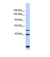 Western blot of Human Fetal Heart. PSD3 antibody dilution 1.0 ug/ml.