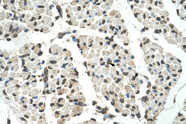 PSD3 antibody LS-C40384 IHC of formalin-fixed, paraffin-embedded human Muscle. Positive label: Skeletal muscle cells indicated with arrows. Antibody concentration 4-8 ug/ml. Magnification 400X.