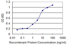 Detection limit for recombinant GST tagged RCBTB2 is 0.3 ng/ml as a capture antibody.