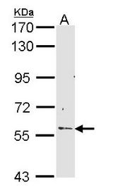 Sample (30 ug of whole cell lysate). A: Hep G2 . 7.5% SDS PAGE. RCBTB2 antibody diluted at 1:1000.