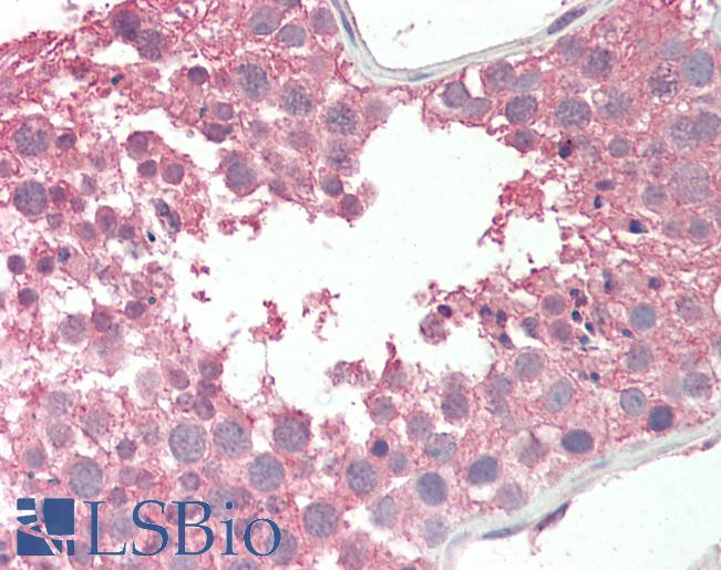 Anti-RCBTB2 antibody IHC staining of human testis. Immunohistochemistry of formalin-fixed, paraffin-embedded tissue after heat-induced antigen retrieval.