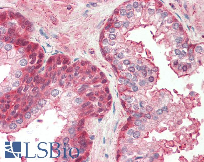 Anti-RCBTB2 antibody IHC staining of human prostate. Immunohistochemistry of formalin-fixed, paraffin-embedded tissue after heat-induced antigen retrieval. Antibody LS-B10300 concentration 5 ug/ml.