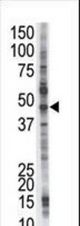 The anti-PSMD4 antibody is used in Western blot to detect PSMD4 in Jurkat cell lysate.
