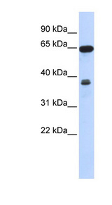 RCC2 antibody LS-C102723 Western blot of 293T cell lysate.