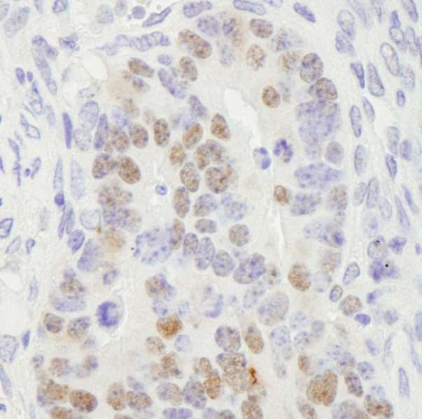 Detection of Mouse RCC2 by Immunohistochemistry. Sample: FFPE section of mouse teratoma. Antibody: Affinity purified rabbit anti-RCC2 used at a dilution of 1:100.