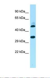 Western blot of Human 721_B. RQCD1 antibody dilution 1.0 ug/ml.